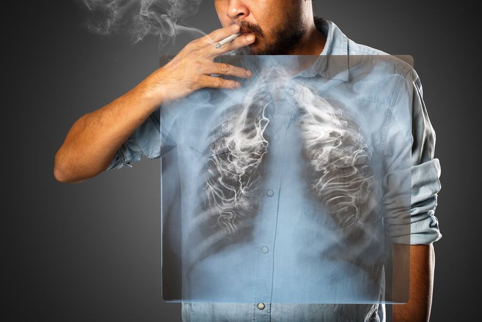 pušenje štetno djeluje na ljudsko tijelo